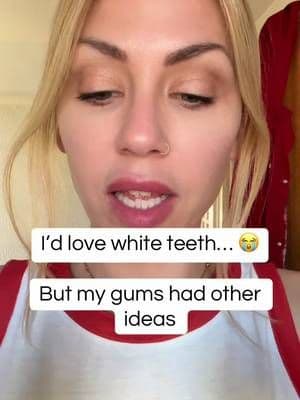I'd love white teeth, but my gums had other ideas 😅 As someone with sensitive teeth and gum recession, whitening products haven't always been my friend. These are the whitening strips I've been using for a while now, and they've become a regular part of my routine. Anyone else have ridiculously sensitive teeth? 🦷✨ @Icy Bear #SensitiveTeeth #TeethWhitening #WhiteningStrips #SmileCare #TikTokShopUK